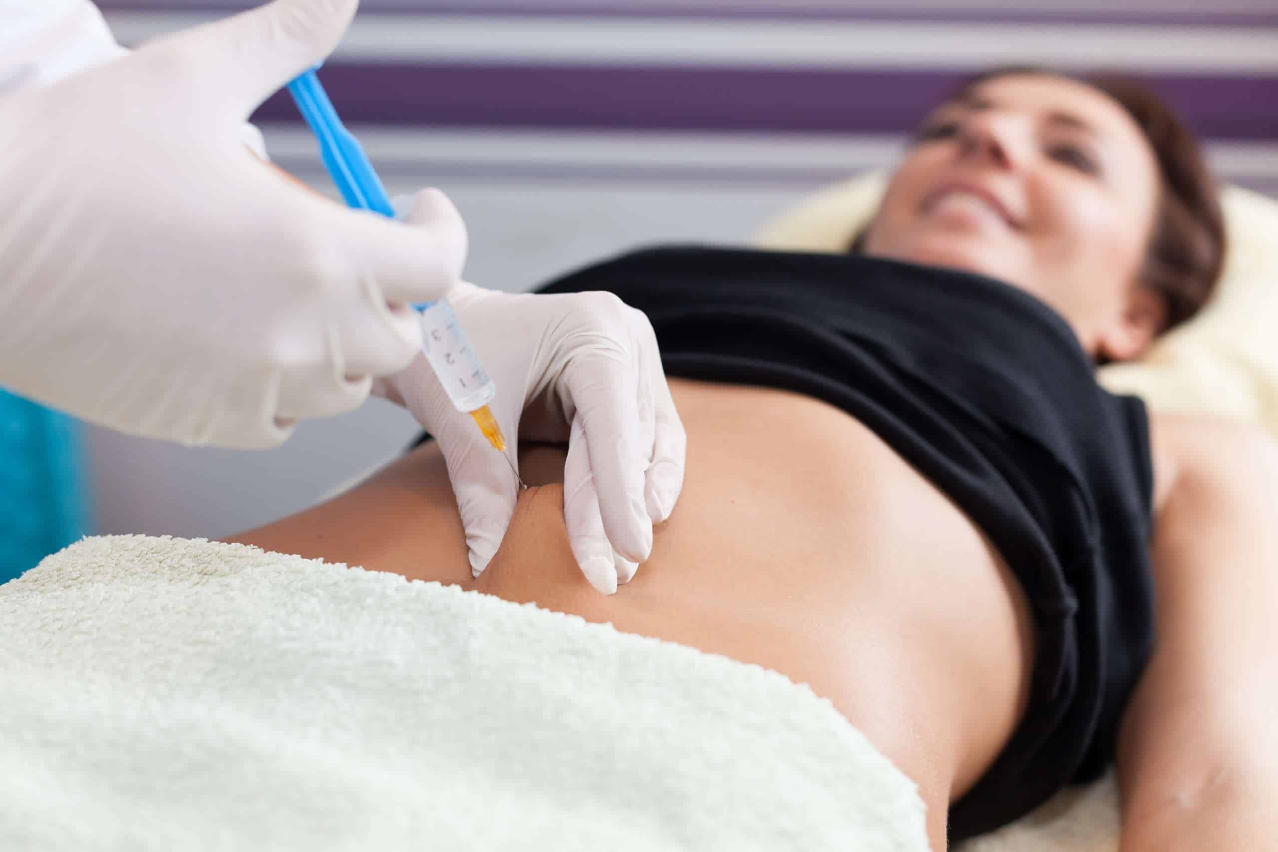 mesotherapy
