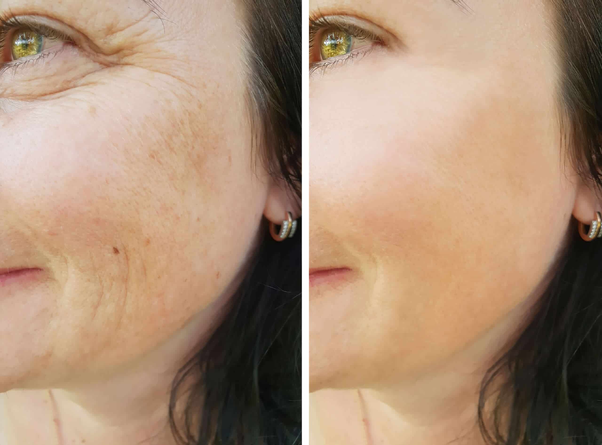 face,woman,wrinkles